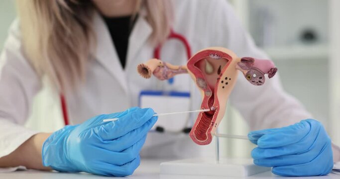 Model of human uterus and cervix taking analysis