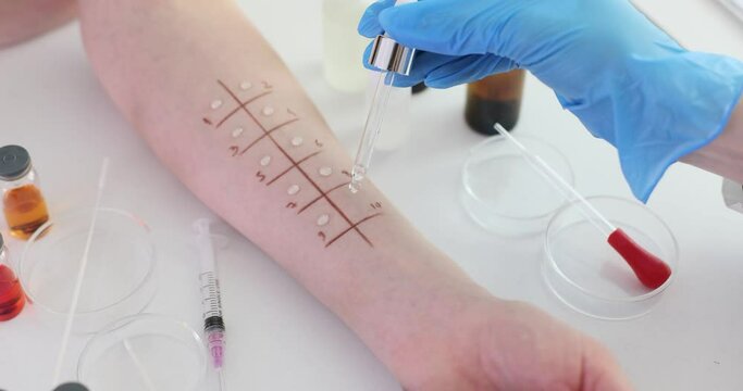 Allergy to skin prick and determine type of allergy