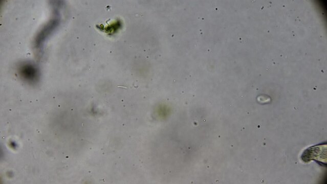 Microscopic exploration of a water droplet from a natural reservoir, showcasing the animated movement of paramecia and spirulina.