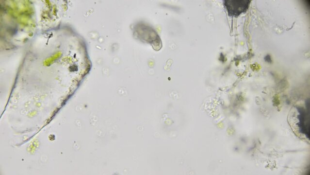Under the microscope, a drop of pond water reveals a dense population of microorganisms, including the swift movements of paramecia and spirulina.