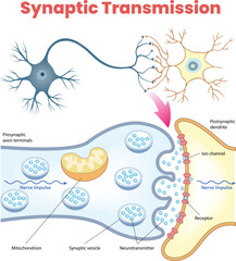 illustration of plantar fibroma diagram
