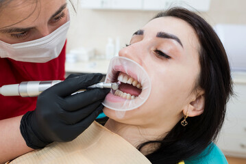Close-up of an orthodontist wearing gloves fitting veneers on a patient's teeth during an appointment at the clinic.