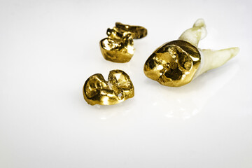 dental_gold