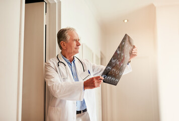 Mature, doctor and holding mri for medical or check, scan with results for brain surgery....