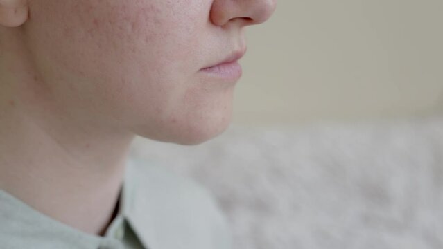 double chin in a caucasian woman. Woman pinching fat on chin and looking at mirror close up