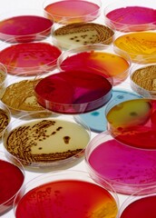 Petri Dishes With Bacteria