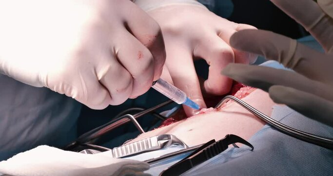 During the operation, the veterinary surgeon injects medication into the pet into the surgical wound area. Close-up of an injection of medicine from a syringe during surgery on a pet.