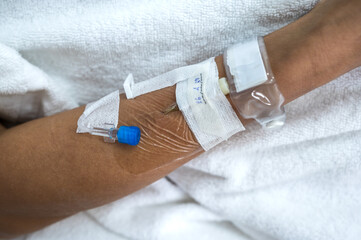 Close up patient arm with needles and bandage in hospital