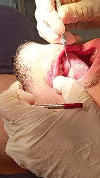 personne recevant des soins dentaires, en gros plan.