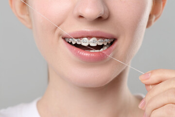 Smiling woman with braces cleaning teeth using dental floss on grey background, closeup