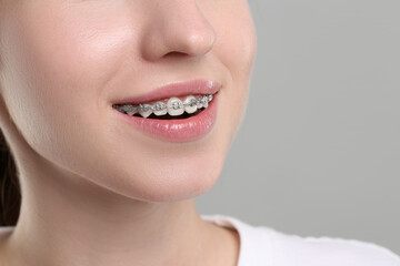 Smiling woman with dental braces on grey background, closeup. Space for text