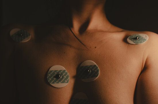 Madrid, Spain. 1 May 2024 Electrodes placed on female chest. Electro diagram sucker on skin body. Heart electro diagram. ECG EKG leads, electrode pads