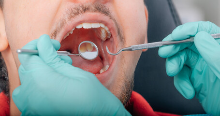 young man patient in the dental clinic