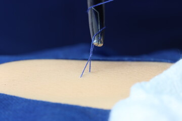 Close up of a skin simulating a suture in a sterile field 