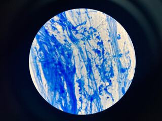 AFB 3+ sample collect sputum.