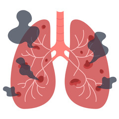 Unhealthy lungs damaged by smoking. No tobacco day concept. Vector illustration