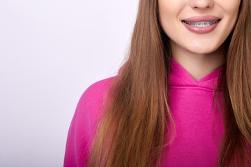 A close-up shot of a young woman smiling joyfully, revealing her braces. Her long flowing brown...
