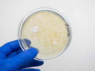 Petri dish with colonies of bacteria Pseudomonas putida, study of bacterial antagonism