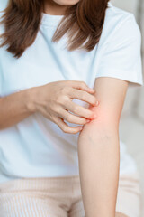 woman itching and scratching itchy arm. Sensitive Skin Allergic reaction to insect bite, food, drug dermatitis. Dermatology, Leprosy day, Systemic lupus erythematosus, Allergy symptoms and rash Eczema