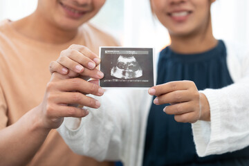 married couple holding and showing ultrasound scan of their baby