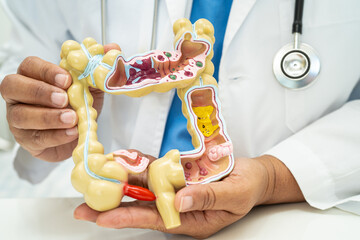 Intestine, appendix and digestive system, doctor holding anatomy model for study diagnosis and...