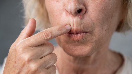Unhappy elderly woman pointing at wrinkles around her lips. 