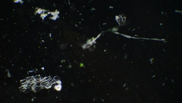 Observe the dynamic interactions of paramecia and spirulina within a droplet of water, magnified to reveal a teeming microcosm.