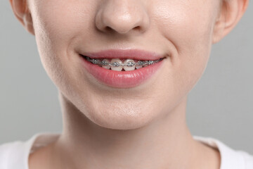 Smiling woman with dental braces on grey background, closeup