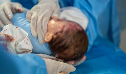 Professional anesthesiologist doctor medical team and assistant is performing baby cesarean section...