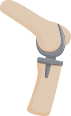 Vector illustration of a modern prosthetic knee joint, isolated on a white background