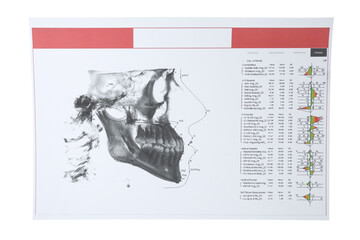 Visualization of human maxillofacial section for dental analysis printed on paper isolated on white