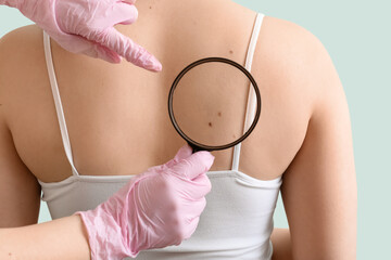 Dermatologist with magnifier examining moles on woman's body against green background, back view