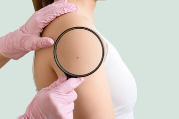 Dermatologist with magnifier examining mole on woman's shoulder against green background, closeup