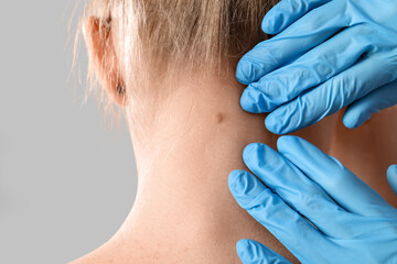 Dermatologist examining mole on woman's neck against light background, back view