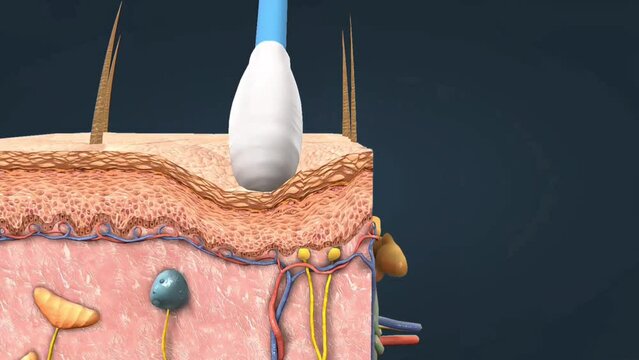 Detection of pressure and touch receptors