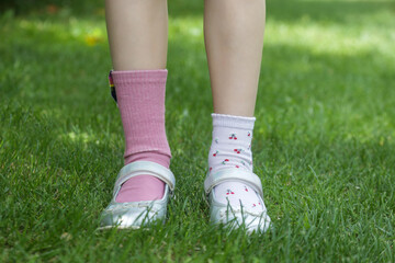 Kid wears different pair of socks. Child foots in mismatched socks standing outdoor.  Down syndrome...