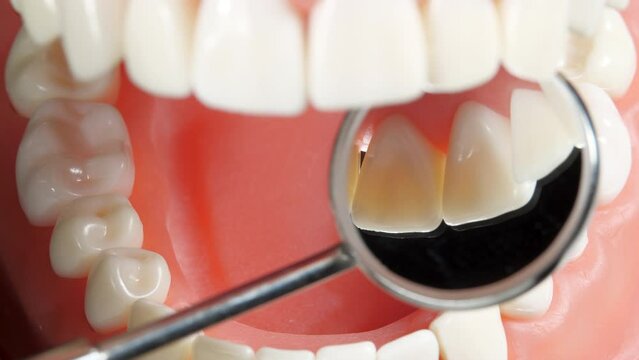Patient at a Dentist Appointment in a Dental Clinic. View to Inside the Dental Jaw. Tooth Model and Treatment Equipment Dental Mirror on Background. Dental Care and Examined Healthy Teeth