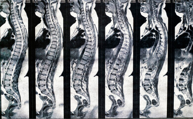 Magnetic computer tomography