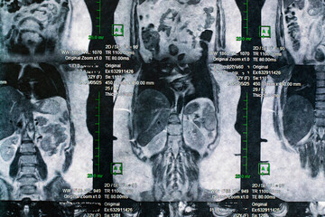 Magnetic computer tomography