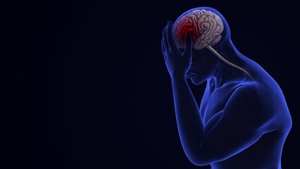 Human Brain Hemorrhagic Disease Patients
