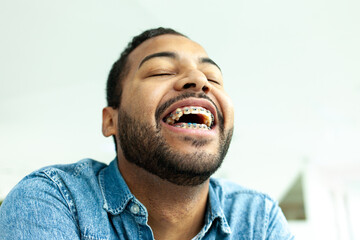 African American man with braces smiles and covers his smile and laughs, man laughs with his eyes...