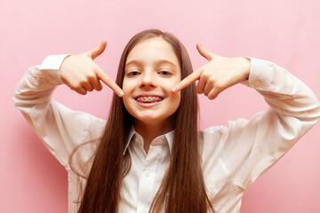 cheerful teenage girl with braces points with finger to the smile on pink isolated background,...