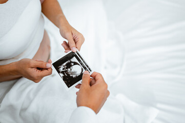 mother, family, abdomen, child, happy, patient, parent, parenthood, pregnancy, motherhood. A couple holding a baby's ultrasound picture. The woman is pregnant and the man is her partner.