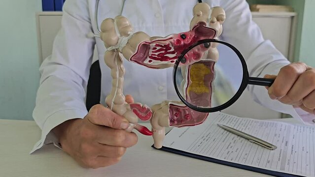 Magnifying glass and colon diseases and colorectal cancer and ulcerative colitis. Irritable bowel syndrome and digestive system