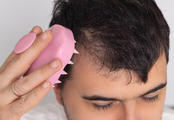 man with bald on head using oil spray, derma roller with needles for hair growth stimulation. guy...