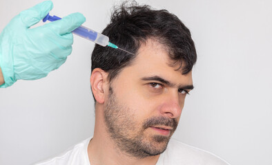 man with baldness on head.doctor in surgical gloves holding syringe, derma roller, oil spray or...
