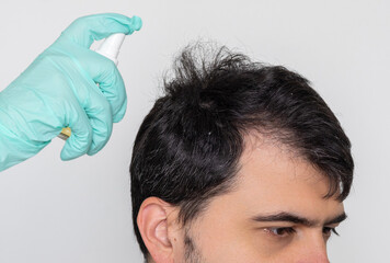 man with baldness on head.doctor in surgical gloves holding syringe, derma roller, oil spray or...