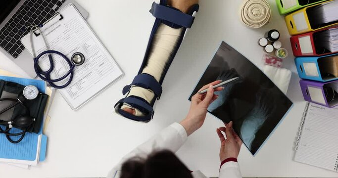 Doctor examines patient with broken leg and top view x-ray