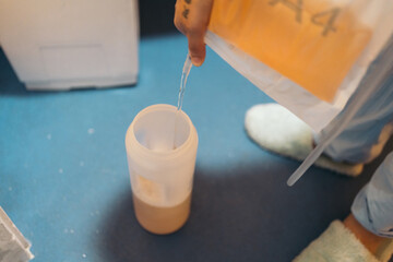 Hands holding a urinary catheter bag, filling a plastic sample container on the floor through a...