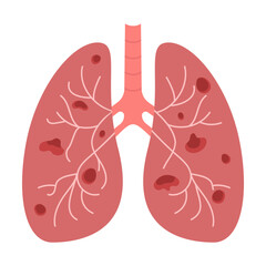 Unhealthy lungs isolated on white. No tobacco day concept. Vector illustration
